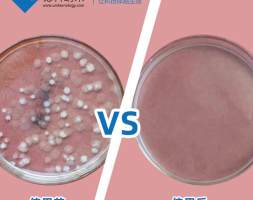 抗菌剂在纺织品有什么作用