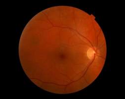 科学家研发新一代人造视网膜，首次将纳米线阵列用于人造视网膜
