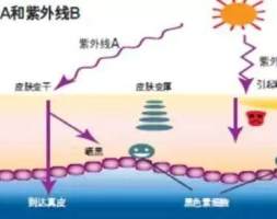 了解紫外线，健康“应烤”有妙招